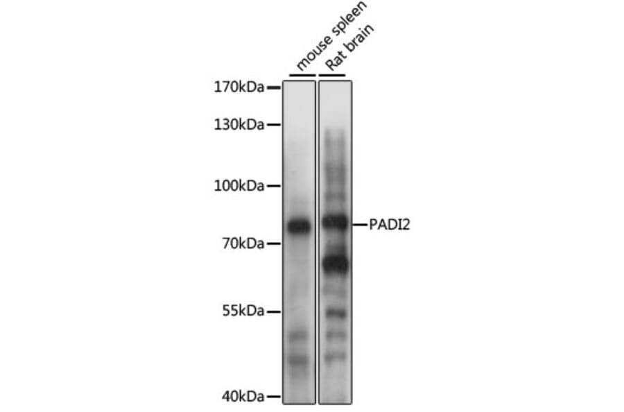 Western Blot - Anti-PADI2/PAD2 Antibody (A80874) - Antibodies.com