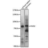 Western Blot - Anti-PADI2/PAD2 Antibody (A80874) - Antibodies.com