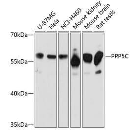 Western Blot - Anti-PP-T Antibody (A80875) - Antibodies.com