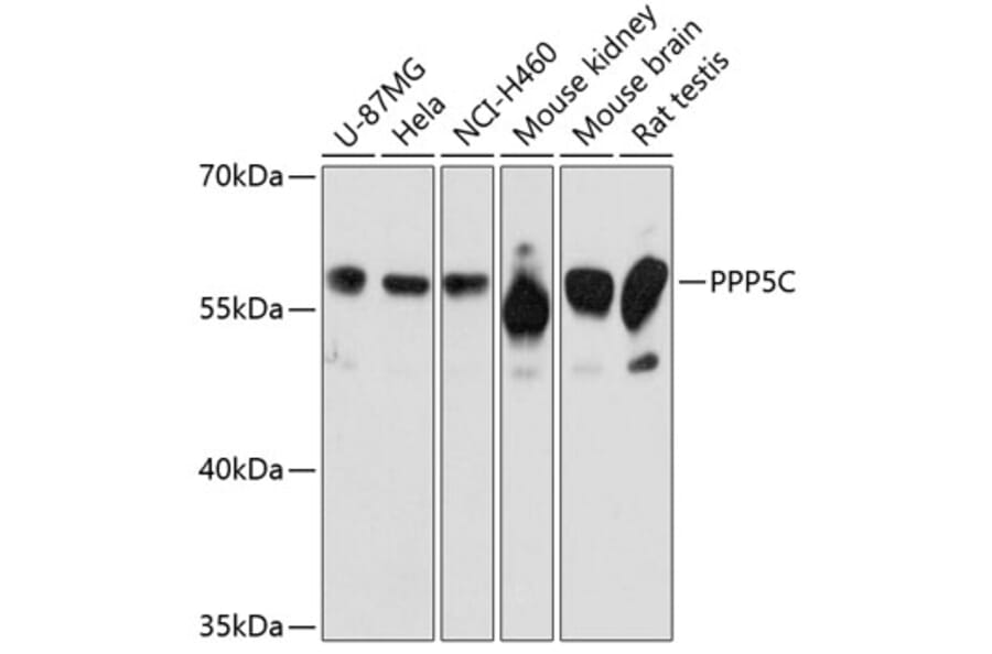 Western Blot - Anti-PP-T Antibody (A80875) - Antibodies.com