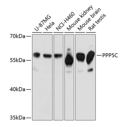 Western Blot - Anti-PP-T Antibody (A80875) - Antibodies.com