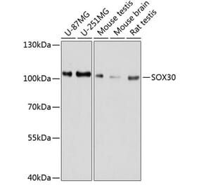 Western Blot - Anti-SOX30 Antibody (A80876) - Antibodies.com