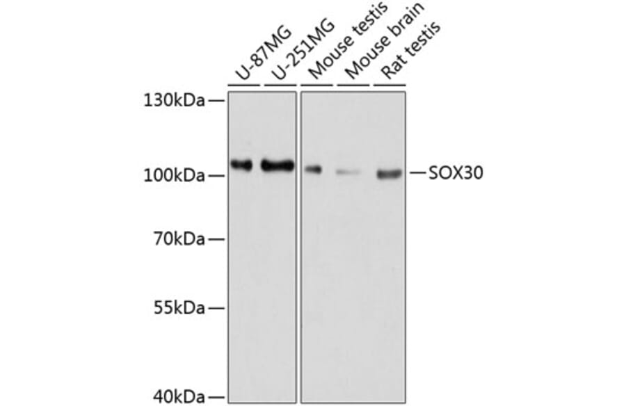 Western Blot - Anti-SOX30 Antibody (A80876) - Antibodies.com