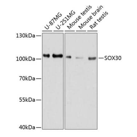 Western Blot - Anti-SOX30 Antibody (A80876) - Antibodies.com