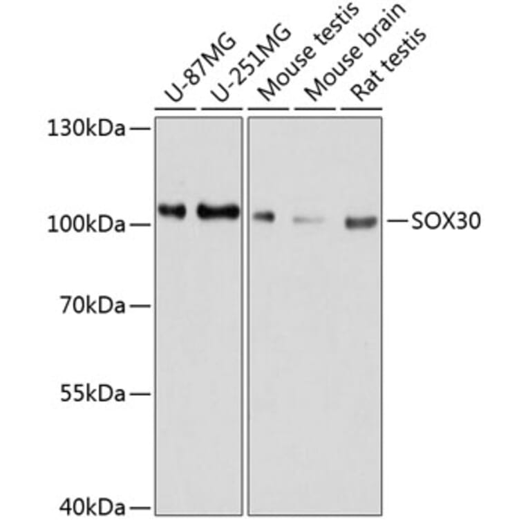 Western Blot - Anti-SOX30 Antibody (A80876) - Antibodies.com