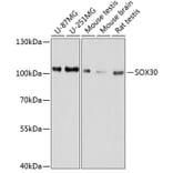 Western Blot - Anti-SOX30 Antibody (A80876) - Antibodies.com