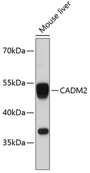 Western blot analysis of extracts of mouse liver, using Anti-CADM2 Antibody (A11724) at 1:3000 dilution.
Secondary antibody: Goat Anti-Rabbit IgG (H+L) (HRP) (AS014) at 1:10,000 dilution.
Lysates / proteins: 25µg per lane.
Blocking buffer: 3% non-fat dry milk in TBST.
Detection: ECL Basic Kit (RM00020).
Exposure time: 90s.
