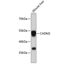 Western Blot - Anti-Cell adhesion molecule 2 Antibody (A80878) - Antibodies.com
