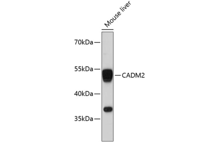 Western Blot - Anti-Cell adhesion molecule 2 Antibody (A80878) - Antibodies.com