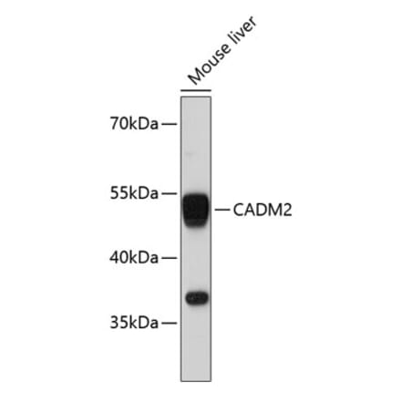 Western Blot - Anti-Cell adhesion molecule 2 Antibody (A80878) - Antibodies.com