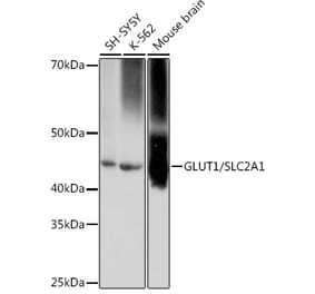Western Blot - Anti-Glucose Transporter GLUT1 Antibody [ARC0304] (A80879) - Antibodies.com