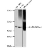 Western Blot - Anti-Glucose Transporter GLUT1 Antibody [ARC0304] (A80879) - Antibodies.com