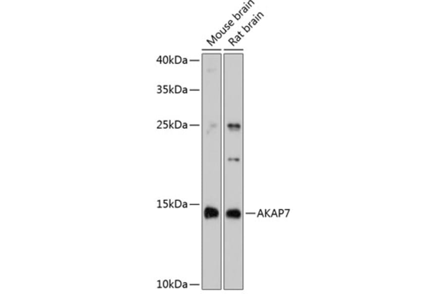 Western Blot - Anti-AKAP7 alpha/beta + AKAP7 gamma Antibody (A80880) - Antibodies.com