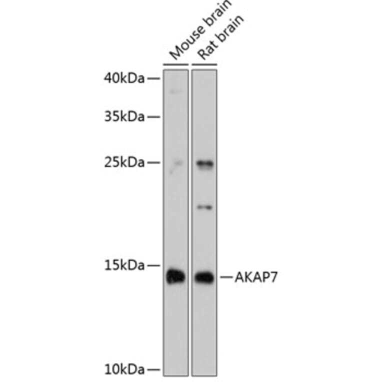Western Blot - Anti-AKAP7 alpha/beta + AKAP7 gamma Antibody (A80880) - Antibodies.com