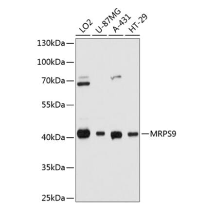 Western Blot - Anti-MRPS9 Antibody (A80881) - Antibodies.com