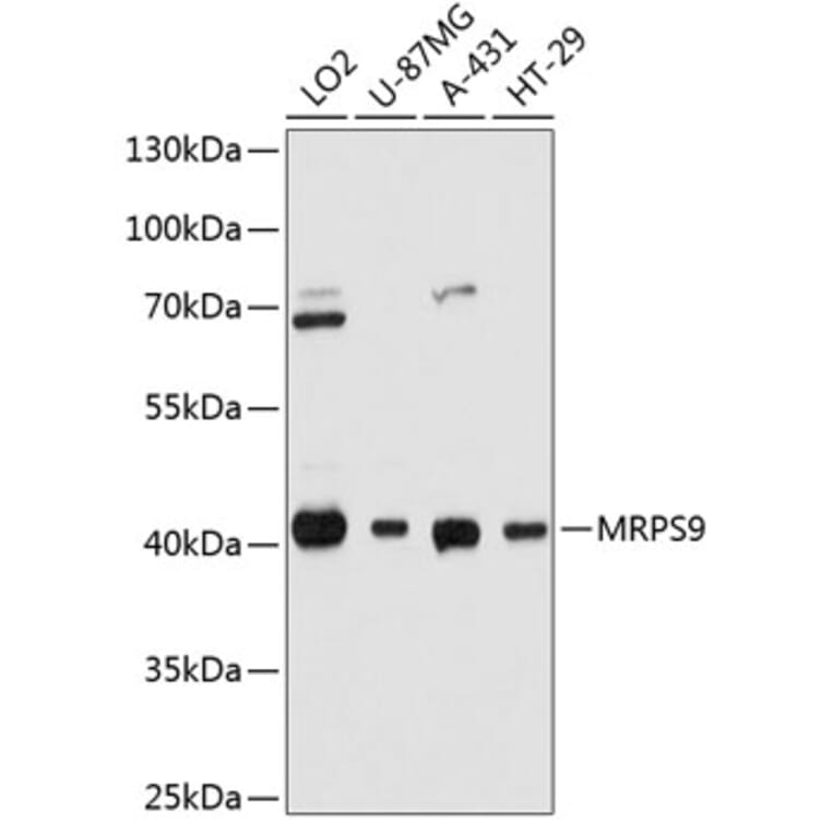 Western Blot - Anti-MRPS9 Antibody (A80881) - Antibodies.com