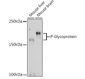 Western Blot - Anti-P Glycoprotein Antibody (A80883) - Antibodies.com