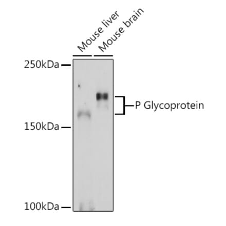 Western Blot - Anti-P Glycoprotein Antibody (A80883) - Antibodies.com