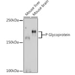 Western Blot - Anti-P Glycoprotein Antibody (A80883) - Antibodies.com