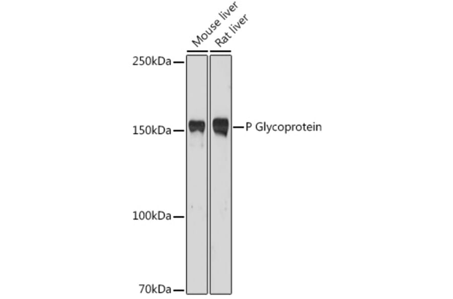 Western Blot - Anti-P Glycoprotein Antibody (A80883) - Antibodies.com