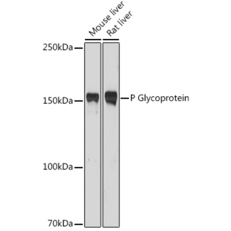 Western Blot - Anti-P Glycoprotein Antibody (A80883) - Antibodies.com