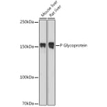 Western Blot - Anti-P Glycoprotein Antibody (A80883) - Antibodies.com