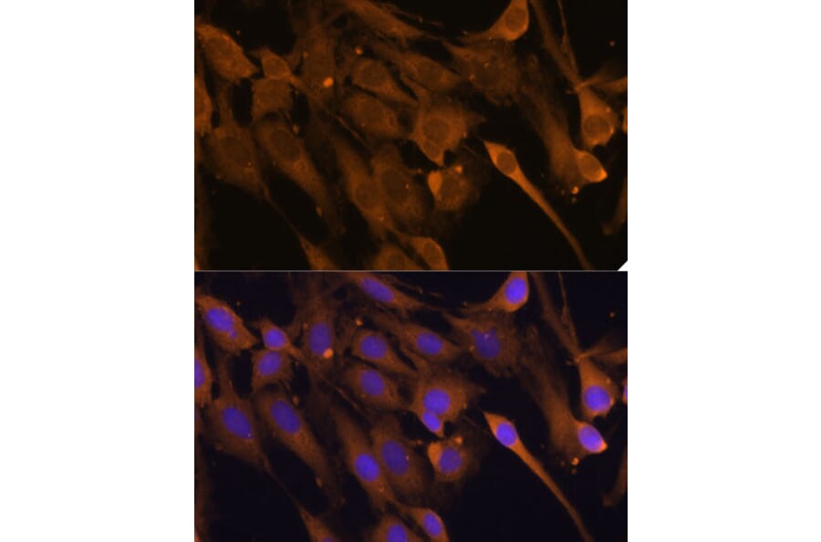 Immunofluorescence - Anti-STUB1/CHIP Antibody (A80884) - Antibodies.com