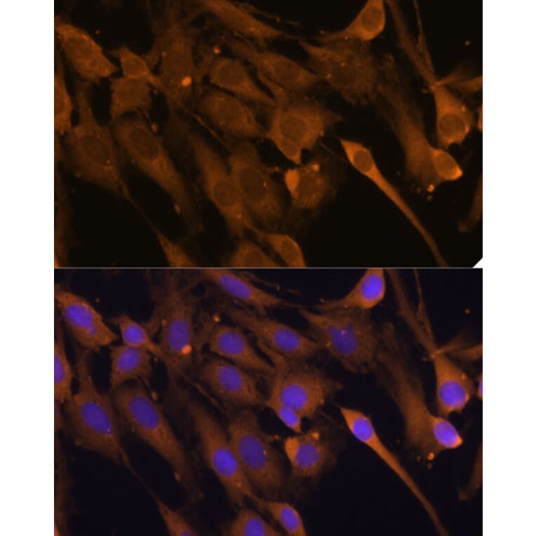 Immunofluorescence - Anti-STUB1/CHIP Antibody (A80884) - Antibodies.com