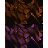 Immunofluorescence - Anti-STUB1/CHIP Antibody (A80884) - Antibodies.com