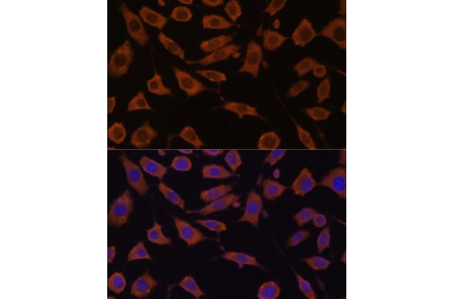 Immunofluorescence - Anti-STUB1/CHIP Antibody (A80884) - Antibodies.com
