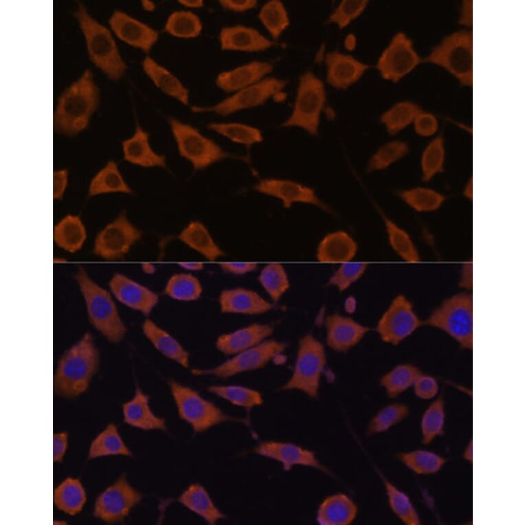 Immunofluorescence - Anti-STUB1/CHIP Antibody (A80884) - Antibodies.com