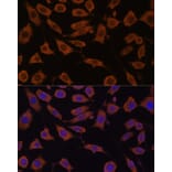 Immunofluorescence - Anti-STUB1/CHIP Antibody (A80884) - Antibodies.com