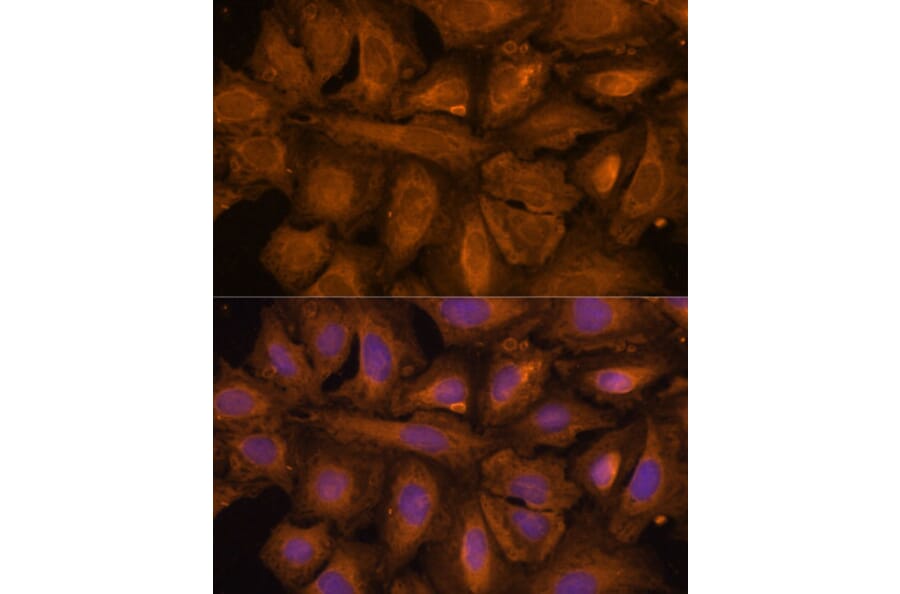 Immunofluorescence - Anti-STUB1/CHIP Antibody (A80884) - Antibodies.com