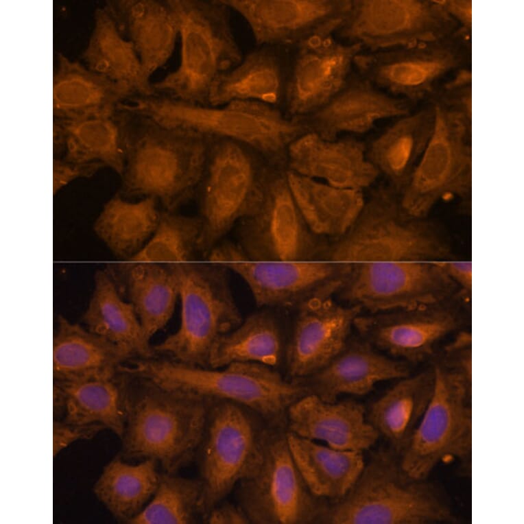 Immunofluorescence - Anti-STUB1/CHIP Antibody (A80884) - Antibodies.com