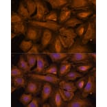 Immunofluorescence - Anti-STUB1/CHIP Antibody (A80884) - Antibodies.com
