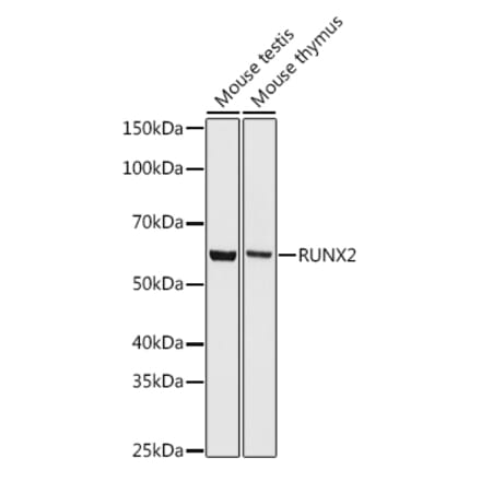 Western Blot - Anti-RUNX2 Antibody [ARC0362] (A80885) - Antibodies.com