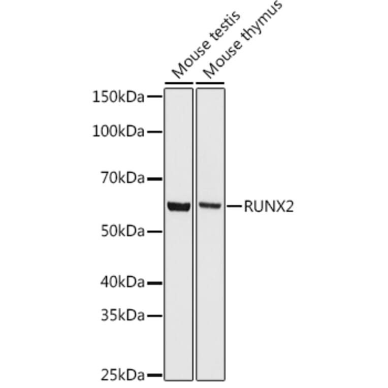 Western Blot - Anti-RUNX2 Antibody [ARC0362] (A80885) - Antibodies.com