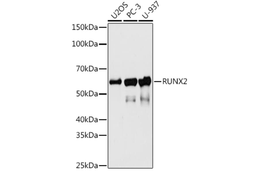 Western Blot - Anti-RUNX2 Antibody [ARC0362] (A80885) - Antibodies.com
