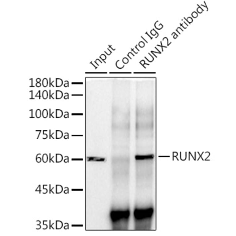 Western Blot - Anti-RUNX2 Antibody [ARC0362] (A80885) - Antibodies.com