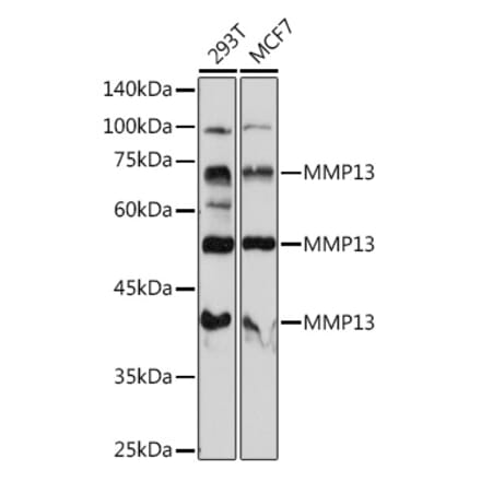 Western Blot - Anti-MMP13 Antibody (A80887) - Antibodies.com