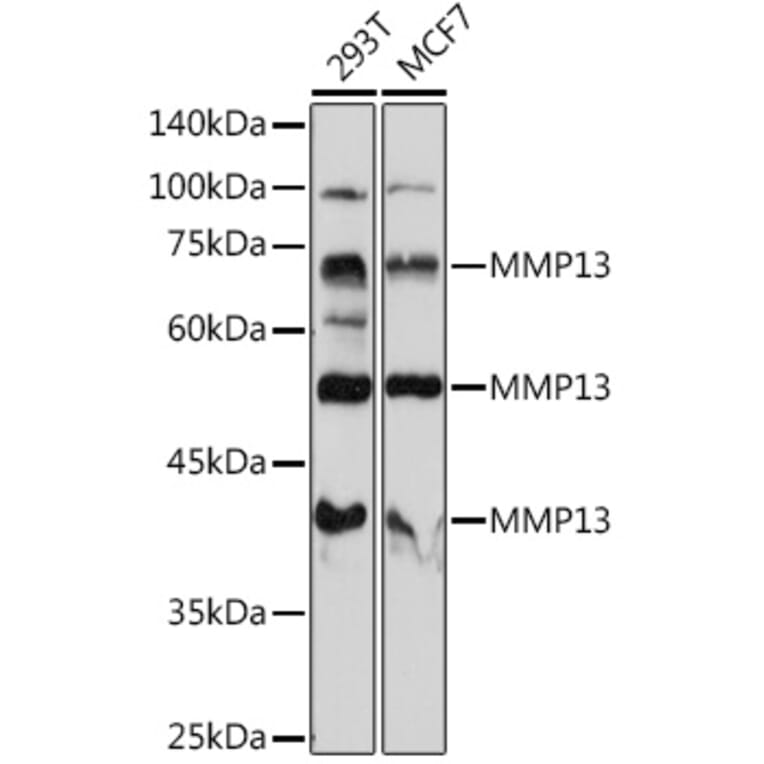 Western Blot - Anti-MMP13 Antibody (A80887) - Antibodies.com