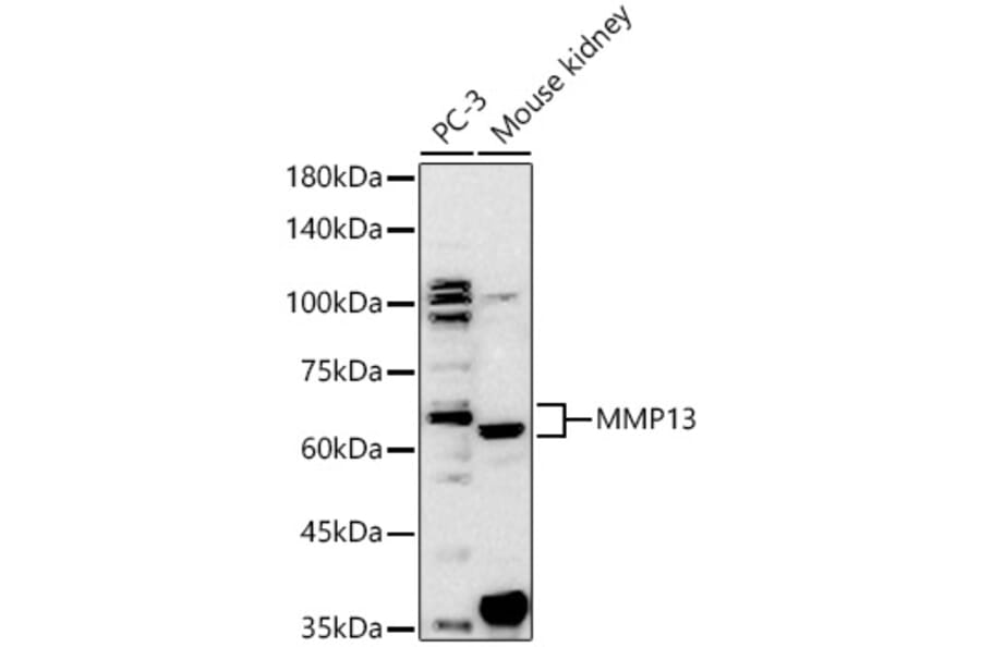 Western Blot - Anti-MMP13 Antibody (A80887) - Antibodies.com