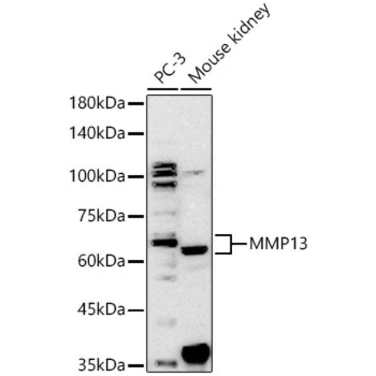 Western Blot - Anti-MMP13 Antibody (A80887) - Antibodies.com