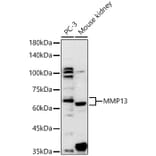 Western Blot - Anti-MMP13 Antibody (A80887) - Antibodies.com
