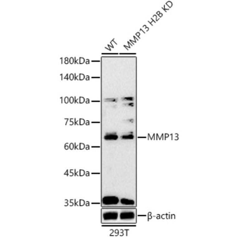 Western Blot - Anti-MMP13 Antibody (A80887) - Antibodies.com