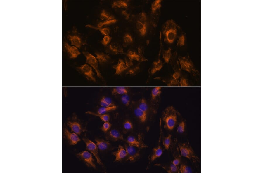 Immunofluorescence - Anti-MMP13 Antibody (A80887) - Antibodies.com