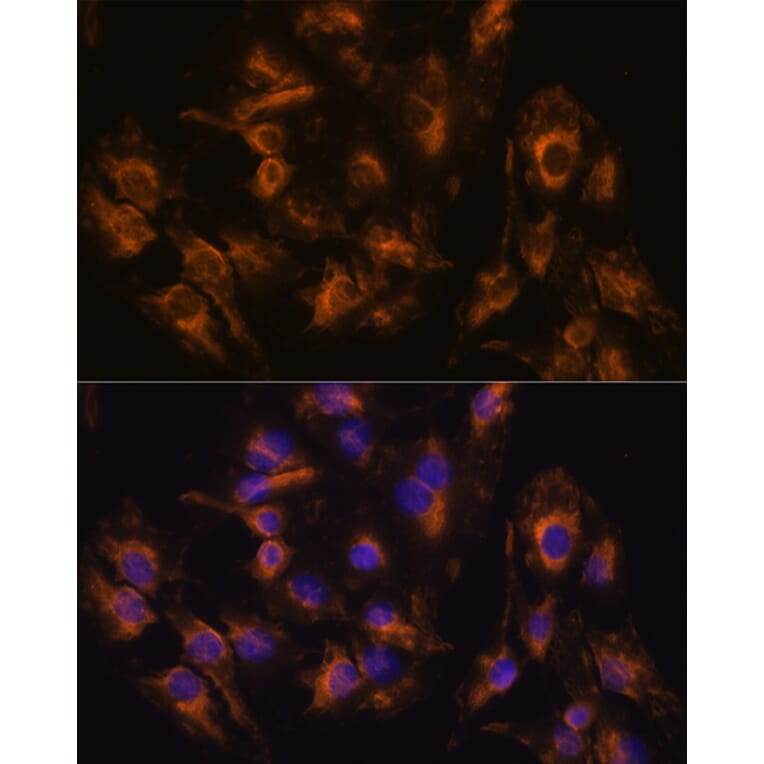 Immunofluorescence - Anti-MMP13 Antibody (A80887) - Antibodies.com