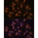 Immunofluorescence - Anti-MMP13 Antibody (A80887) - Antibodies.com