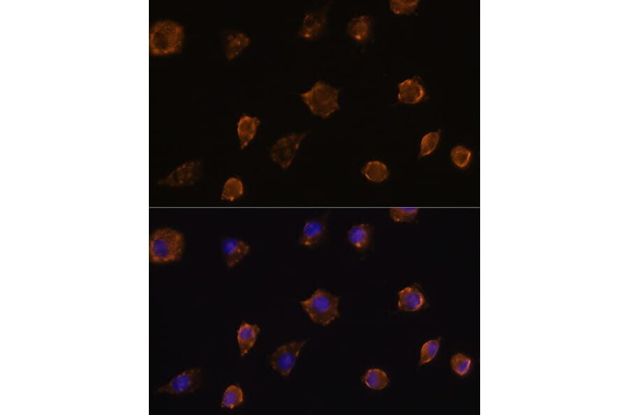 Immunofluorescence - Anti-MMP13 Antibody (A80887) - Antibodies.com