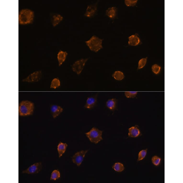 Immunofluorescence - Anti-MMP13 Antibody (A80887) - Antibodies.com